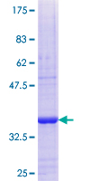 TSNAX / TRAX Protein - 12.5% SDS-PAGE Stained with Coomassie Blue.