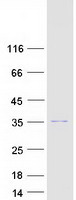 TSNAX / TRAX Protein - Purified recombinant protein TSNAX was analyzed by SDS-PAGE gel and Coomassie Blue Staining