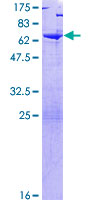 TSNAXIP1 Protein - 12.5% SDS-PAGE of human TSNAXIP1 stained with Coomassie Blue