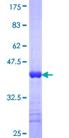 TSNAXIP1 Protein - 12.5% SDS-PAGE Stained with Coomassie Blue.