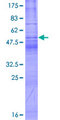 TSPAN1 / TM4SF Protein - 12.5% SDS-PAGE of human TSPAN1 stained with Coomassie Blue