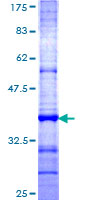 TSPAN1 / TM4SF Protein - 12.5% SDS-PAGE Stained with Coomassie Blue.