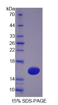 TSPAN1 / TM4SF Protein - Recombinant  Tetraspanin 1 By SDS-PAGE