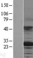 TSPAN12 Protein - Western validation with an anti-DDK antibody * L: Control HEK293 lysate R: Over-expression lysate