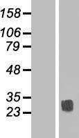 TSPAN14 Protein - Western validation with an anti-DDK antibody * L: Control HEK293 lysate R: Over-expression lysate