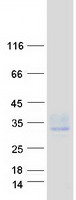 TSPAN15 Protein - Purified recombinant protein TSPAN15 was analyzed by SDS-PAGE gel and Coomassie Blue Staining