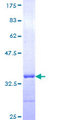 TSPAN2 Protein - 12.5% SDS-PAGE Stained with Coomassie Blue.