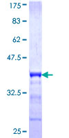 TSPAN20 / UPK1B Protein - 12.5% SDS-PAGE Stained with Coomassie Blue.