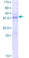 TSPAN3 Protein - 12.5% SDS-PAGE of human TSPAN3 stained with Coomassie Blue