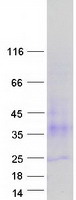 TSPAN3 Protein - Purified recombinant protein TSPAN3 was analyzed by SDS-PAGE gel and Coomassie Blue Staining
