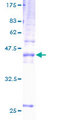 TSPAN31 Protein - 12.5% SDS-PAGE of human SAS stained with Coomassie Blue
