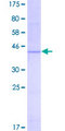 TSPO / PBR Protein - 12.5% SDS-PAGE of human TSPO stained with Coomassie Blue