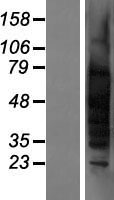 TSPY1 / TSPY Protein - Western validation with an anti-DDK antibody * L: Control HEK293 lysate R: Over-expression lysate