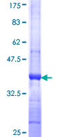 TSPY1 / TSPY Protein - 12.5% SDS-PAGE Stained with Coomassie Blue.