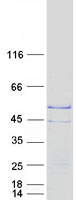 TSPY2 Protein - Purified recombinant protein TSPY2 was analyzed by SDS-PAGE gel and Coomassie Blue Staining