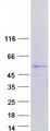 TSPY4 Protein - Purified recombinant protein TSPY4 was analyzed by SDS-PAGE gel and Coomassie Blue Staining