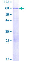 TSPYL1 Protein - 12.5% SDS-PAGE of human TSPYL1 stained with Coomassie Blue