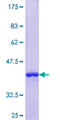 TSPYL1 Protein - 12.5% SDS-PAGE Stained with Coomassie Blue.