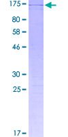 TSPYL2 / DENTT Protein - 12.5% SDS-PAGE of human TSPYL2 stained with Coomassie Blue