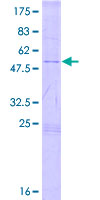 TSPYL4 Protein - 12.5% SDS-PAGE of human TSPYL4 stained with Coomassie Blue