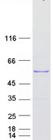 TSPYL4 Protein - Purified recombinant protein TSPYL4 was analyzed by SDS-PAGE gel and Coomassie Blue Staining