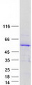 TSPYL5 Protein - Purified recombinant protein TSPYL5 was analyzed by SDS-PAGE gel and Coomassie Blue Staining