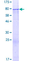 TSPYL6 Protein - 12.5% SDS-PAGE of human TSPYL6 stained with Coomassie Blue