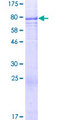 TSPYL6 Protein - 12.5% SDS-PAGE of human TSPYL6 stained with Coomassie Blue