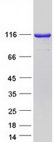 TSR1 Protein - Purified recombinant protein TSR1 was analyzed by SDS-PAGE gel and Coomassie Blue Staining