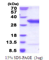TSR2 Protein