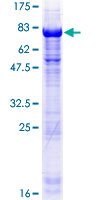 TSSC1 Protein - 12.5% SDS-PAGE of human TSSC1 stained with Coomassie Blue