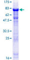 TSSC1 Protein - 12.5% SDS-PAGE of human TSSC1 stained with Coomassie Blue