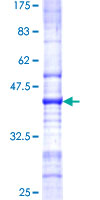 TSSC1 Protein - 12.5% SDS-PAGE Stained with Coomassie Blue.