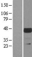TSSK1B Protein - Western validation with an anti-DDK antibody * L: Control HEK293 lysate R: Over-expression lysate