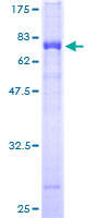 TSSK1B Protein - 12.5% SDS-PAGE of human TSSK1 stained with Coomassie Blue