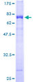 TSSK1B Protein - 12.5% SDS-PAGE of human TSSK1 stained with Coomassie Blue