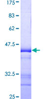 TSSK1B Protein - 12.5% SDS-PAGE Stained with Coomassie Blue.