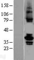 TSSK2 Protein - Western validation with an anti-DDK antibody * L: Control HEK293 lysate R: Over-expression lysate