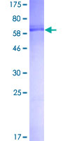 TSSK2 Protein - 12.5% SDS-PAGE of human TSSK2 stained with Coomassie Blue