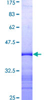TSSK2 Protein - 12.5% SDS-PAGE Stained with Coomassie Blue.