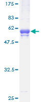 TSSK3 / STK22C Protein - 12.5% SDS-PAGE of human TSSK3 stained with Coomassie Blue