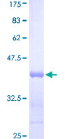 TSSK3 / STK22C Protein - 12.5% SDS-PAGE Stained with Coomassie Blue.