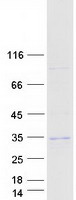 TSSK3 / STK22C Protein - Purified recombinant protein TSSK3 was analyzed by SDS-PAGE gel and Coomassie Blue Staining