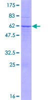 TSSK6 Protein - 12.5% SDS-PAGE of human TSSK6 stained with Coomassie Blue