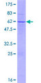 TSSK6 Protein - 12.5% SDS-PAGE of human TSSK6 stained with Coomassie Blue
