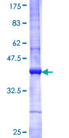 TSSK6 Protein - 12.5% SDS-PAGE Stained with Coomassie Blue.