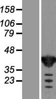 TSTA3 /  GDP-L-Fucose Synthase Protein - Western validation with an anti-DDK antibody * L: Control HEK293 lysate R: Over-expression lysate