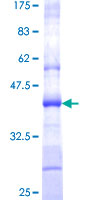 TSTA3 /  GDP-L-Fucose Synthase Protein - 12.5% SDS-PAGE Stained with Coomassie Blue