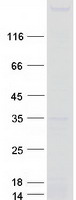 TTBK1 Protein - Purified recombinant protein TTBK1 was analyzed by SDS-PAGE gel and Coomassie Blue Staining