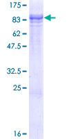 TTBK2 Protein - 12.5% SDS-PAGE of human TTBK2 stained with Coomassie Blue